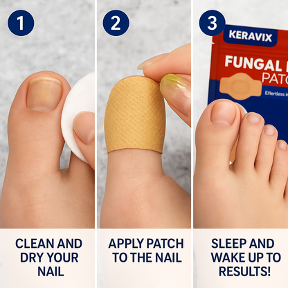 FungaClear™ - Fungal Nail Renewal Patches