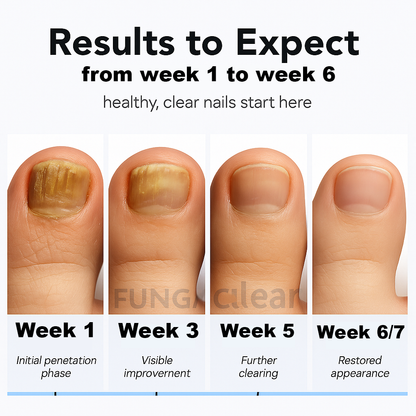 FungaClear™ - Fungal Nail Renewal Patches